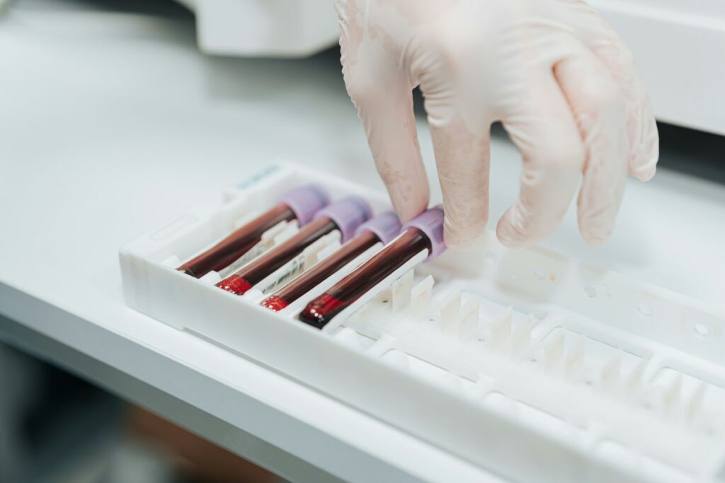 °CRYO Biomarkers Test