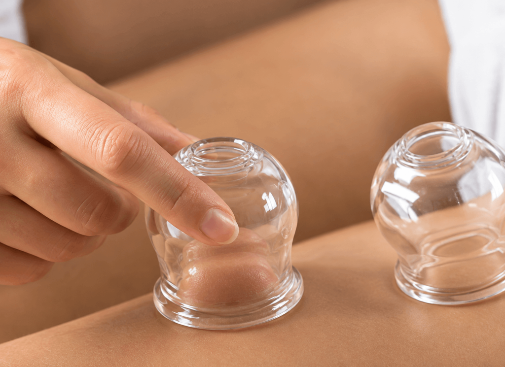 Cellulite Cupping