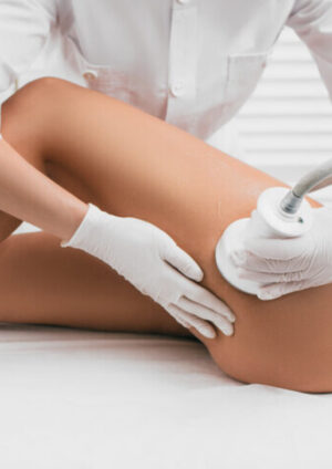 Cryo Cryo Slim Cellulite