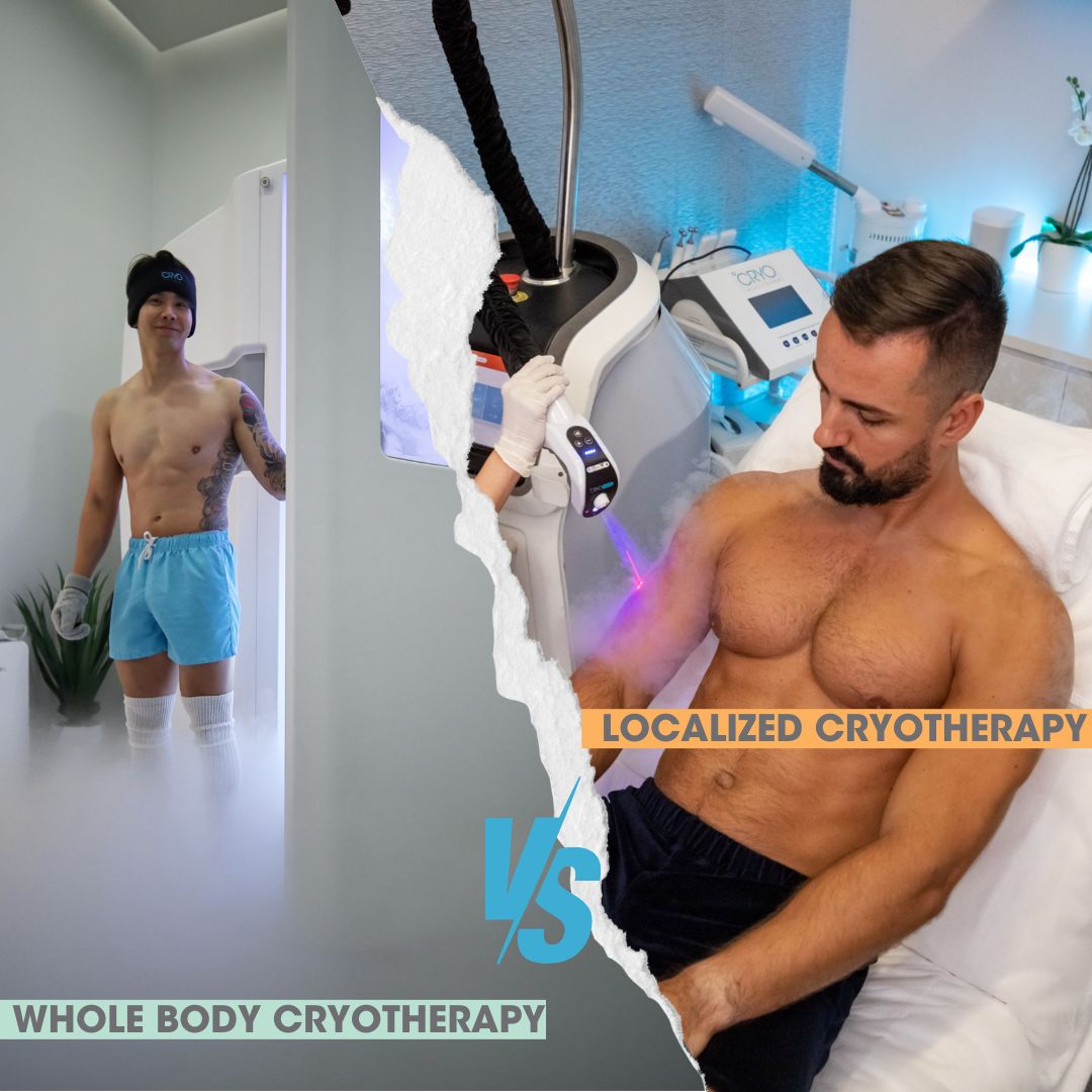 Localized or Whole Body? Which cryotherapy treatment should I choose?